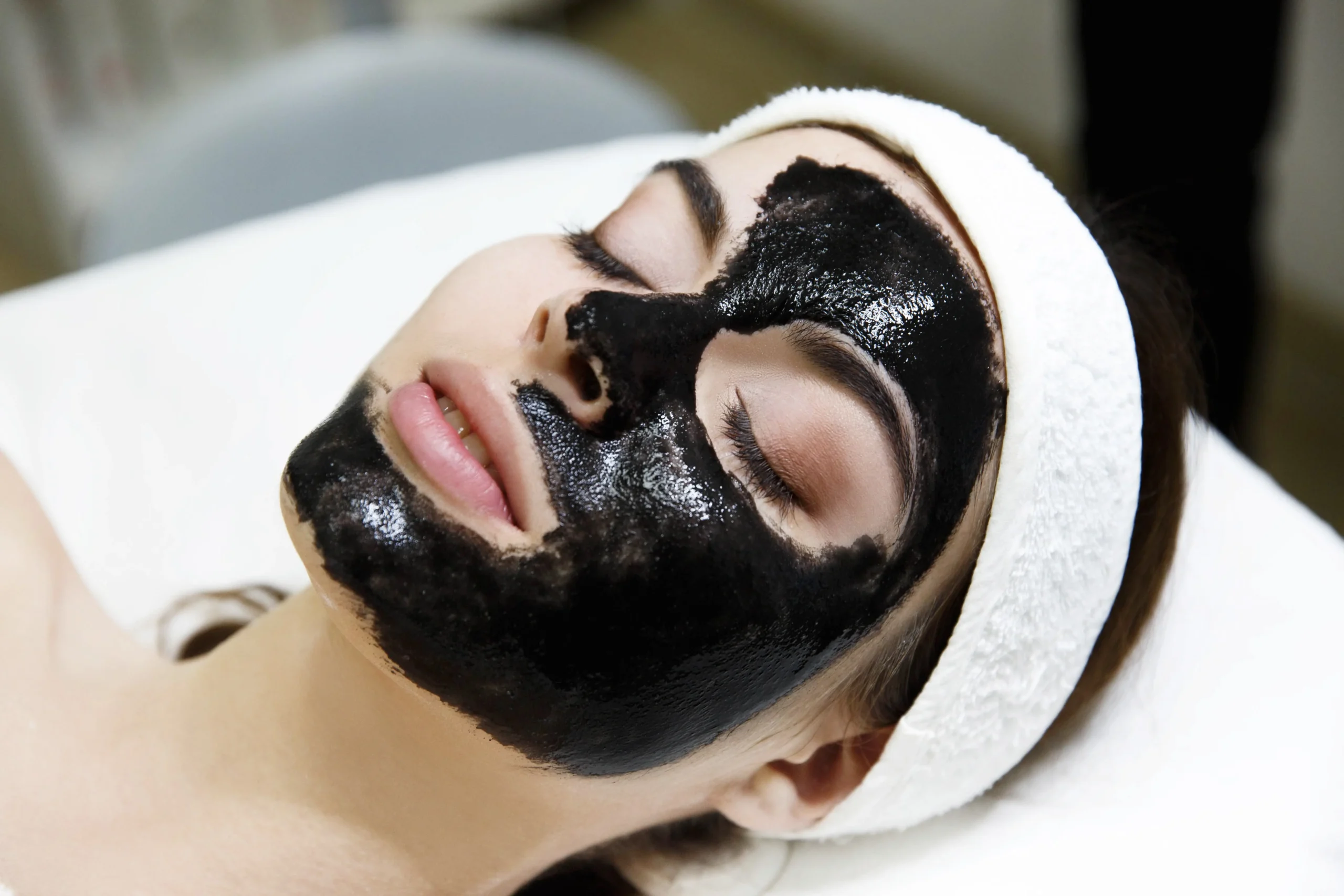 Carbon laser peel benefits for skin