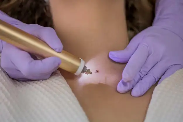 Mole removal treatments in Thrissur